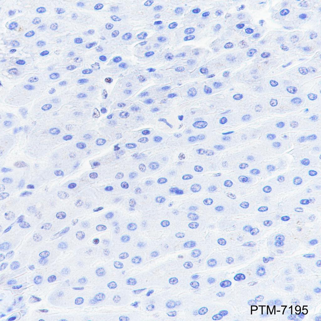 Anti-DNAJC6 Rabbit mAb