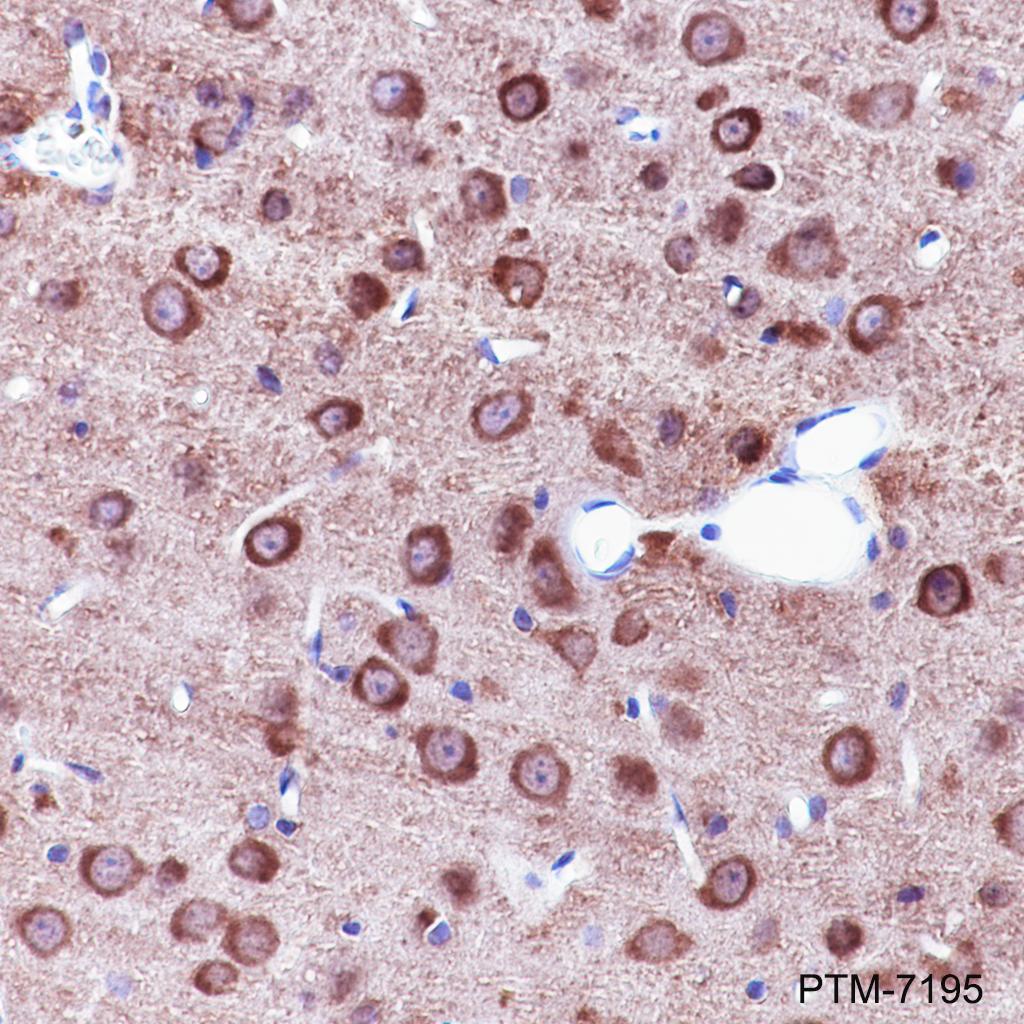 Anti-DNAJC6 Rabbit mAb