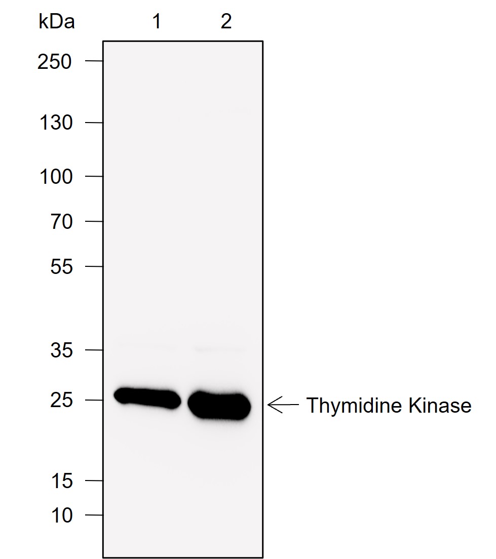 Anti-Thymidine Kinase 1 Mouse mAb