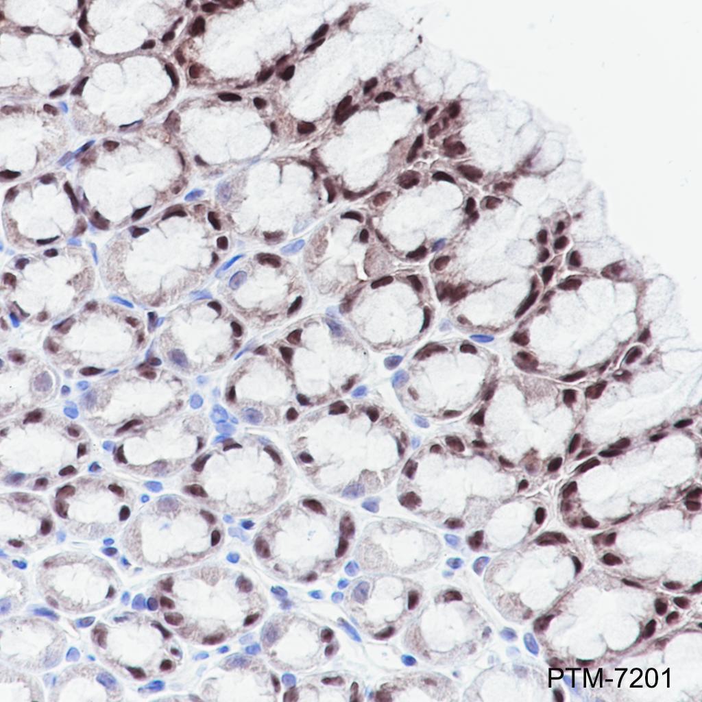 Anti-CLIC1 Rabbit mAb