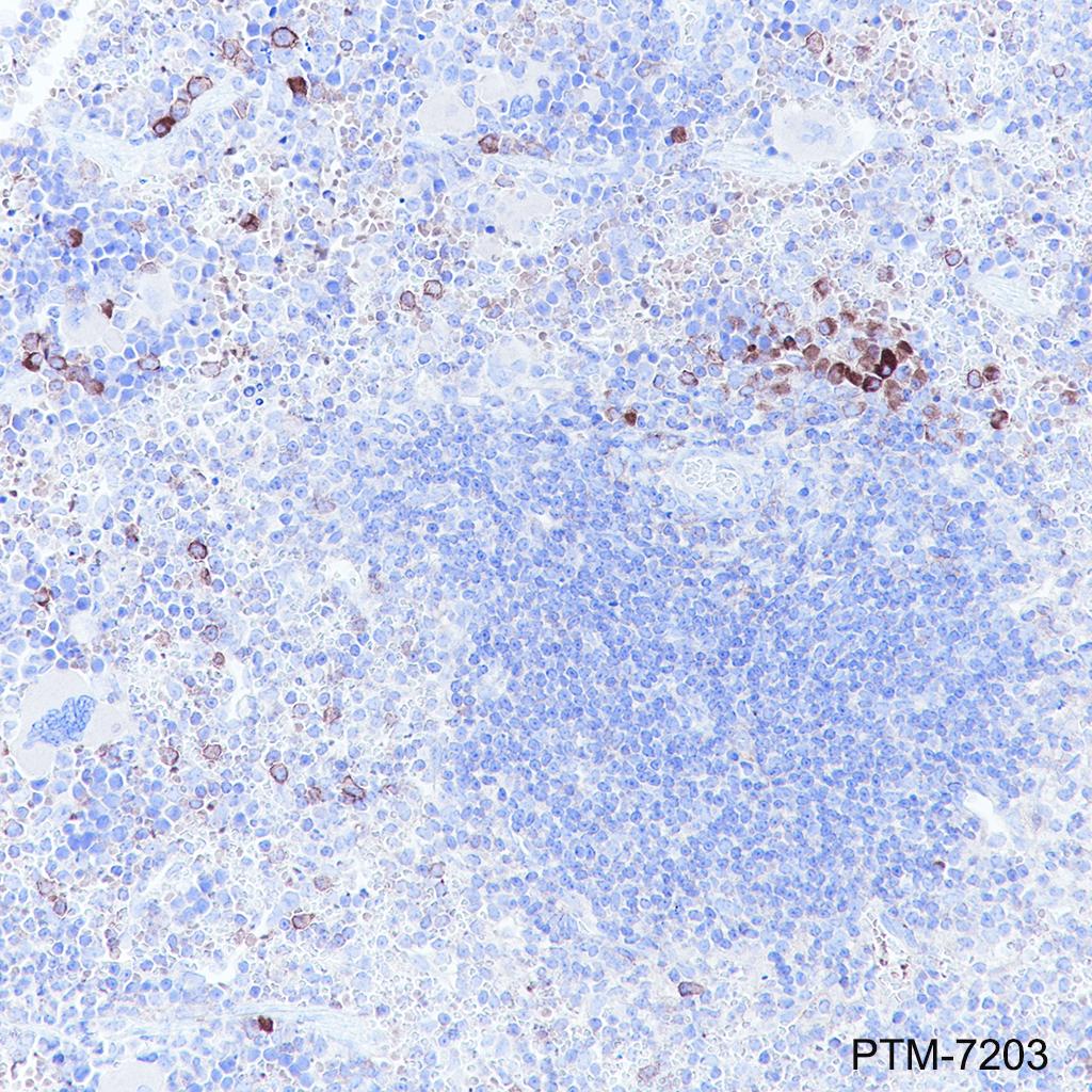 Anti-CCR2 Rabbit mAb