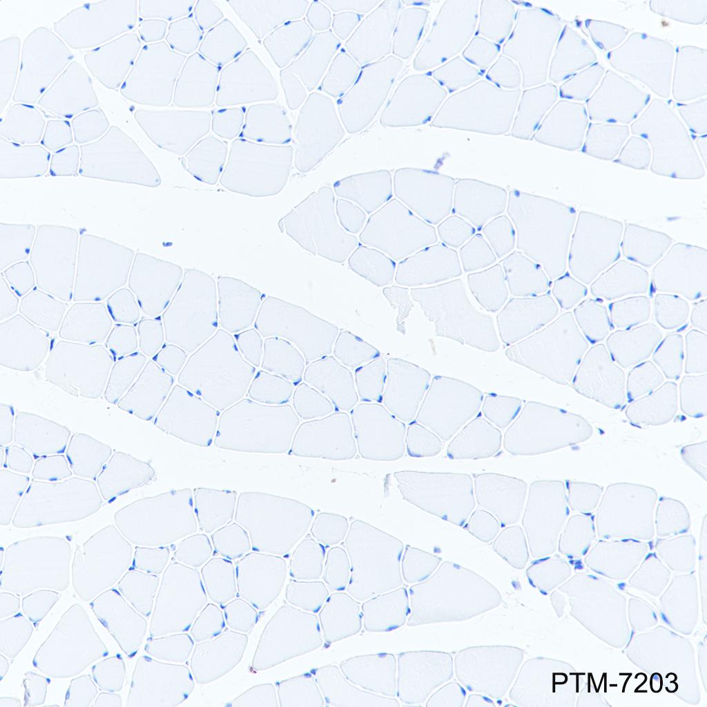 Anti-CCR2 Rabbit mAb