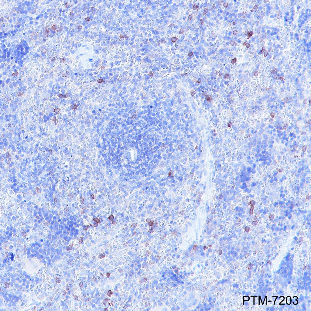 Anti-CCR2 Rabbit mAb