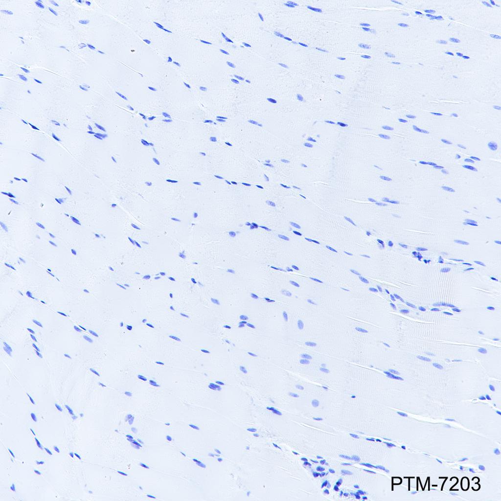 Anti-CCR2 Rabbit mAb