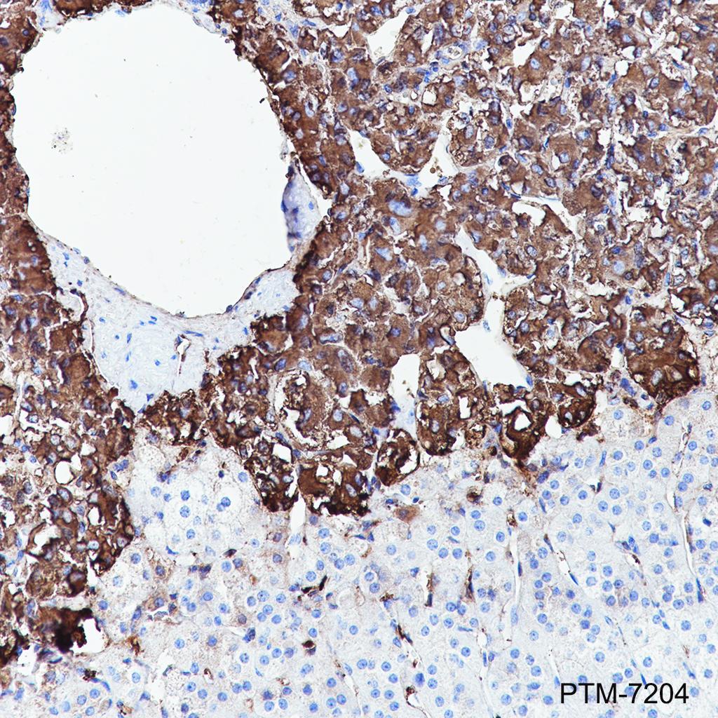 Anti-Chromogranin A Rabbit mAb
