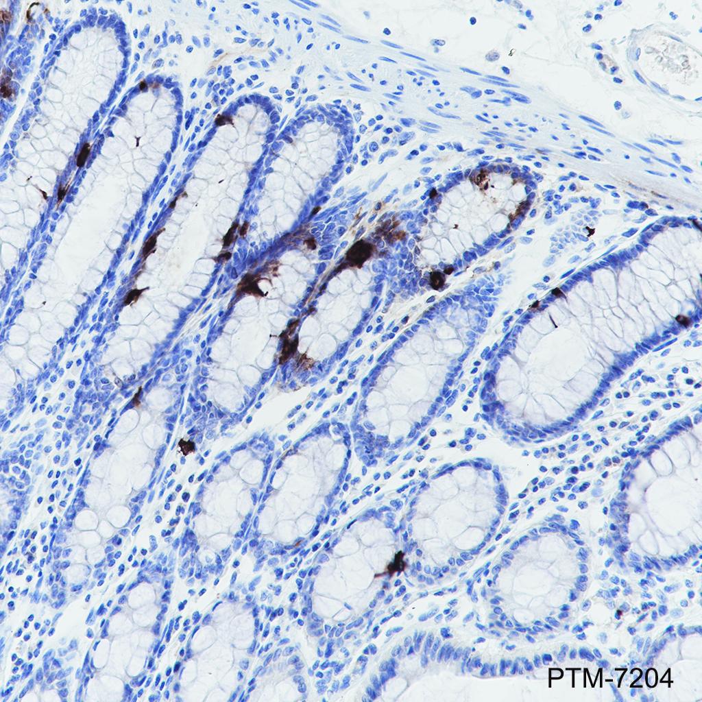 Anti-Chromogranin A Rabbit mAb