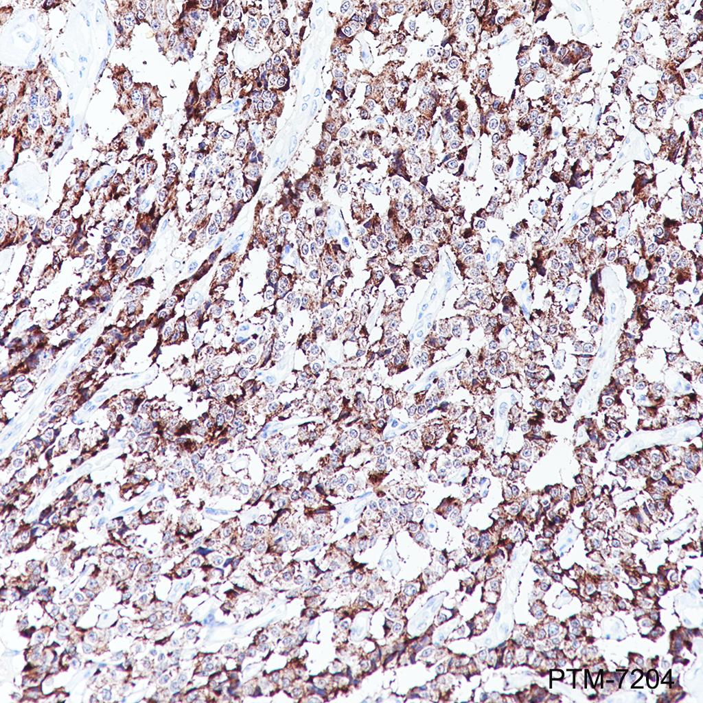Anti-Chromogranin A Rabbit mAb