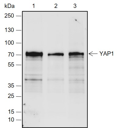 Anti-YAP1 Rabbit mAb