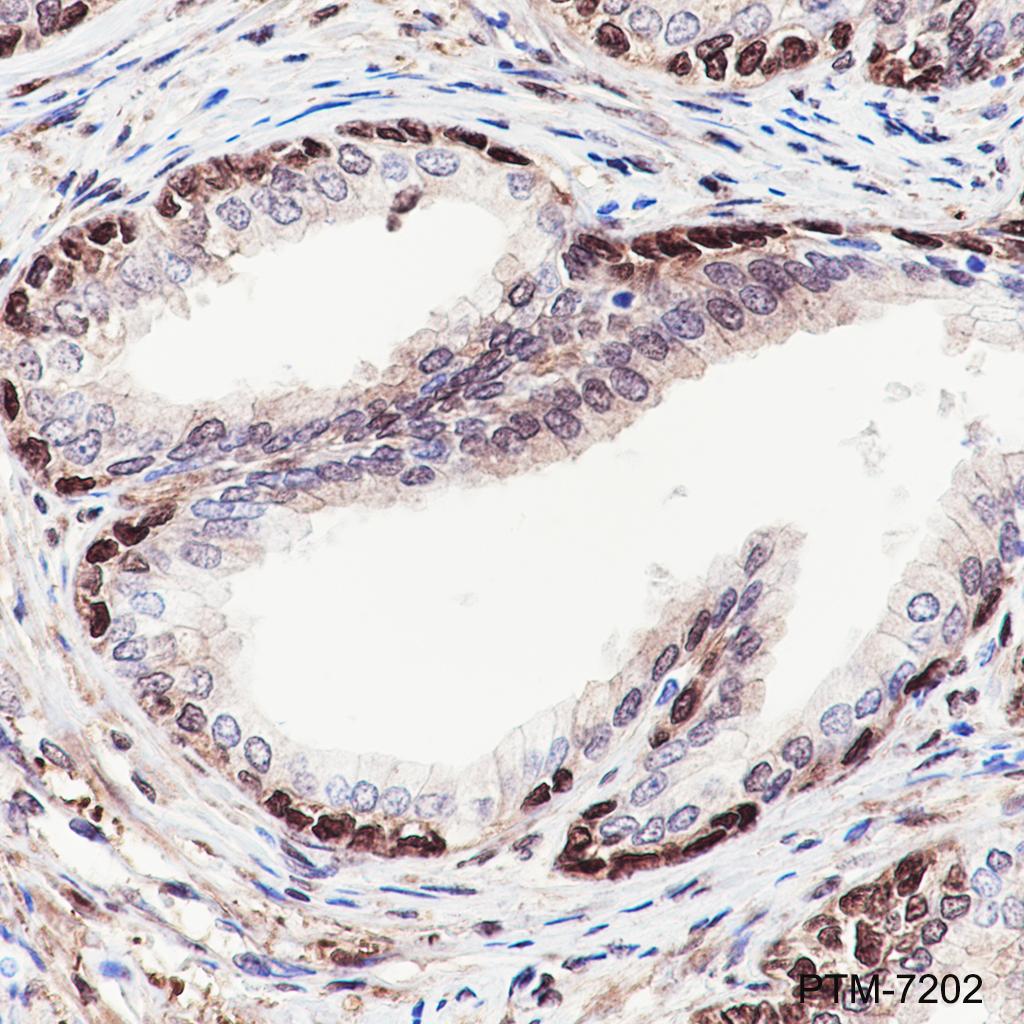 Anti-YAP1 Rabbit mAb