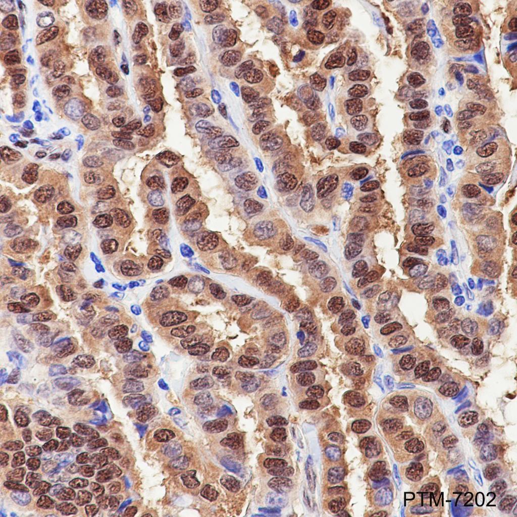 Anti-YAP1 Rabbit mAb