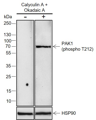 Anti-Phospho-PAK1 (Thr212) Rabbit mAb
