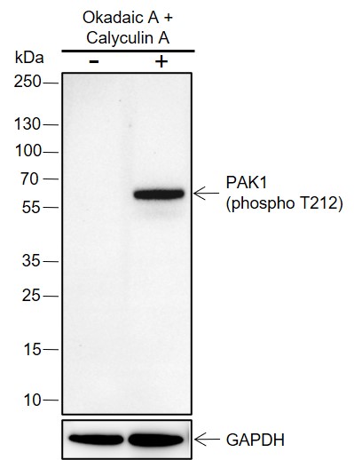 Anti-Phospho-PAK1 (Thr212) Rabbit mAb