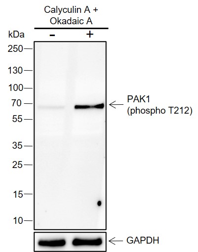 Anti-Phospho-PAK1 (Thr212) Rabbit mAb