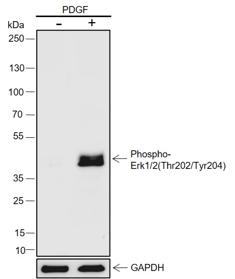 Anti-Phospho-Erk1/2(Thr202/Tyr204) Rabbit mAb