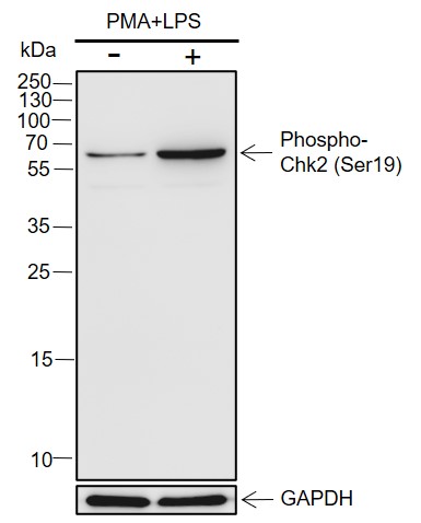 Anti-Phospho-Chk2 (Ser19) Rabbit pAb