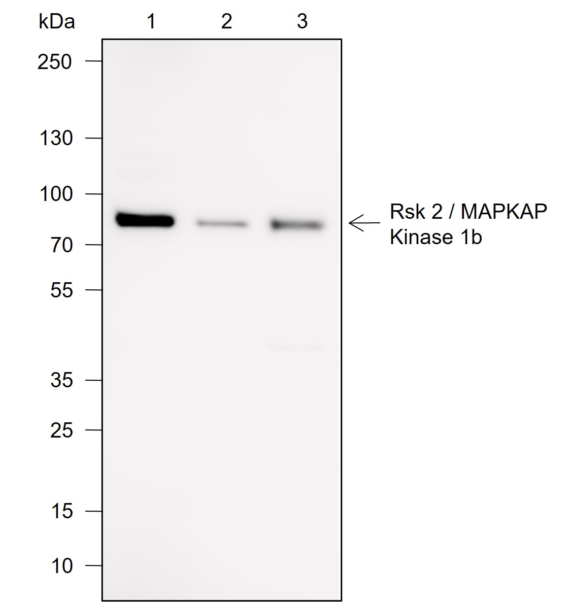Anti-RSK2 Rabbit mAb