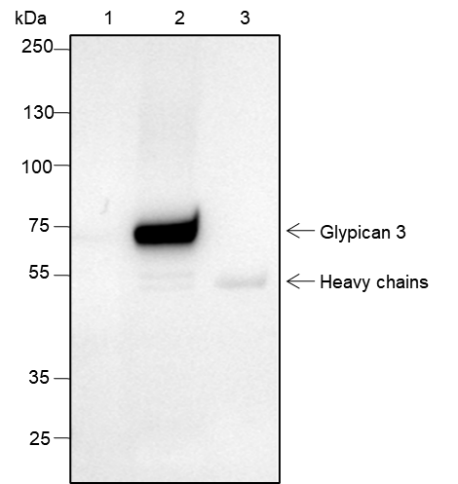 Anti-Glypican 3 Rabbit mAb