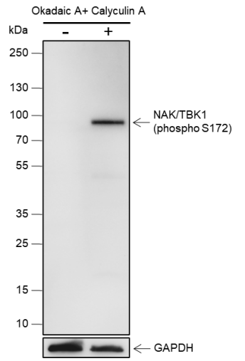 Anti-Phospho-TBK1/NAK (Ser172) Rabbit mAb