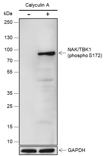 Anti-Phospho-TBK1/NAK (Ser172) Rabbit mAb