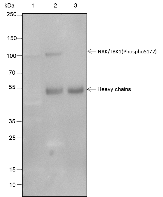 Anti-Phospho-TBK1/NAK (Ser172) Rabbit mAb