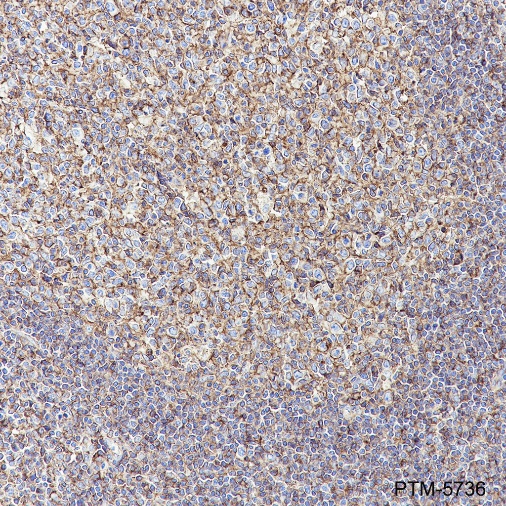 Anti-CCR6 Rabbit mAb