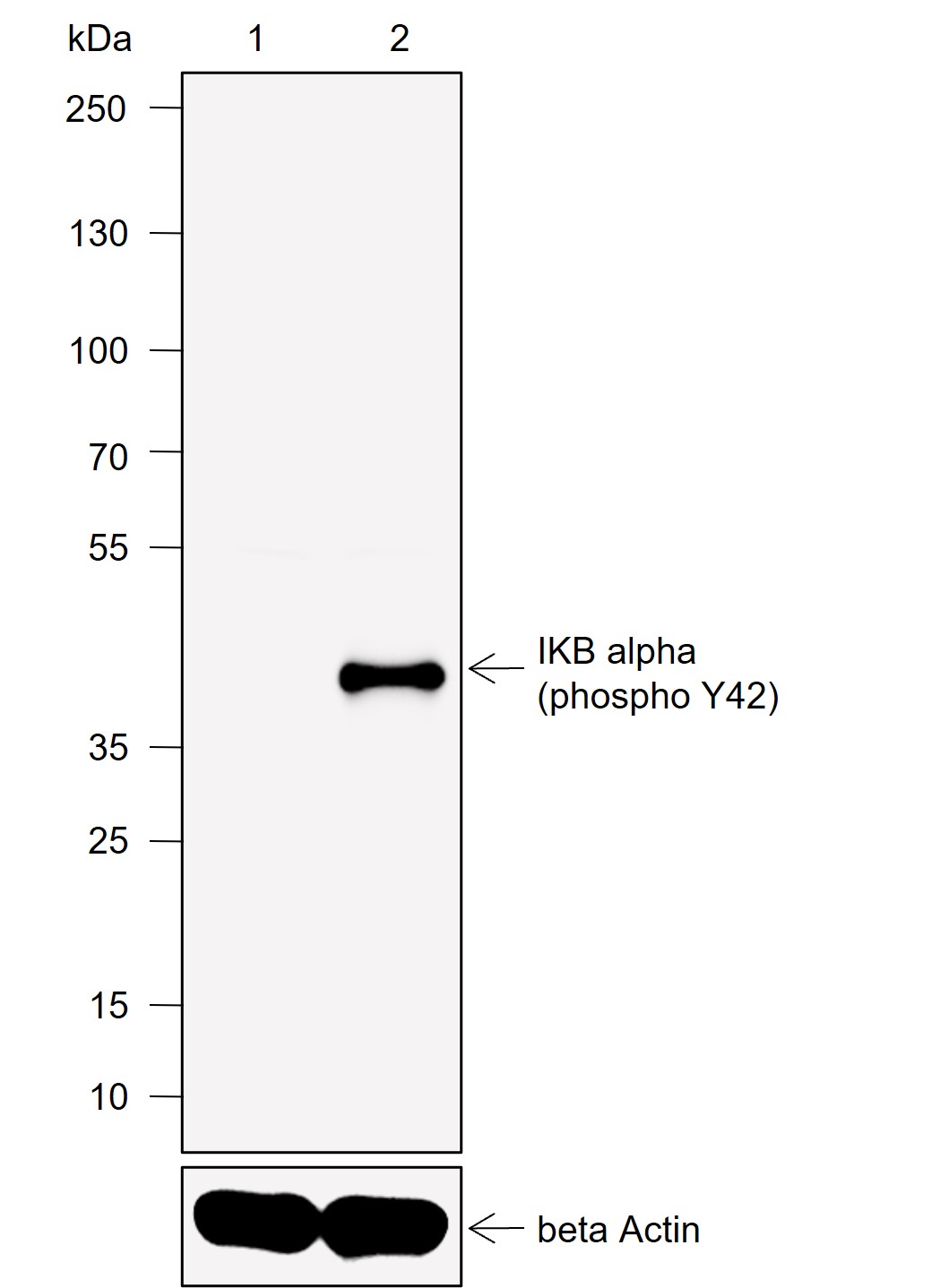 Anti-Phospho-IkB alpha (Tyr42) Rabbit mAb