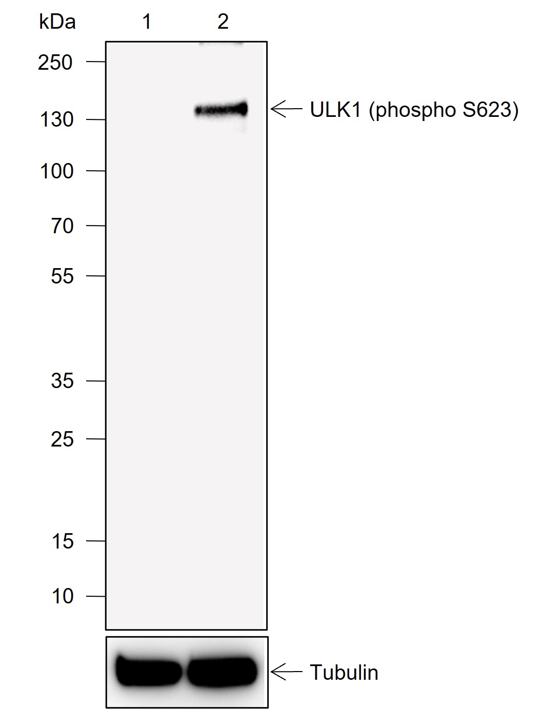 Anti-Phospho-ULK1 (Ser623) Rabbit mAb