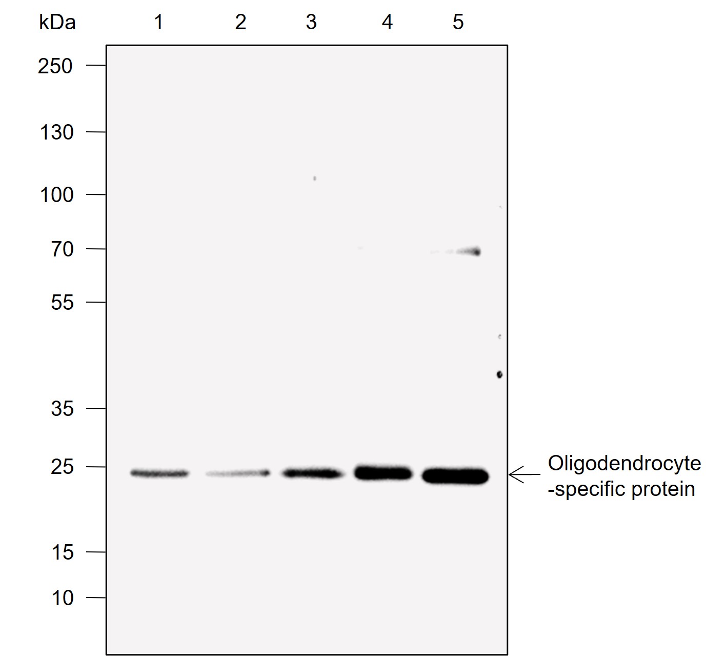 Anti-Claudin-11 Rabbit mAb
