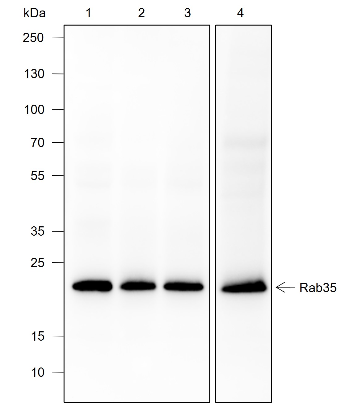 Anti-Rab35 Rabbit mAb