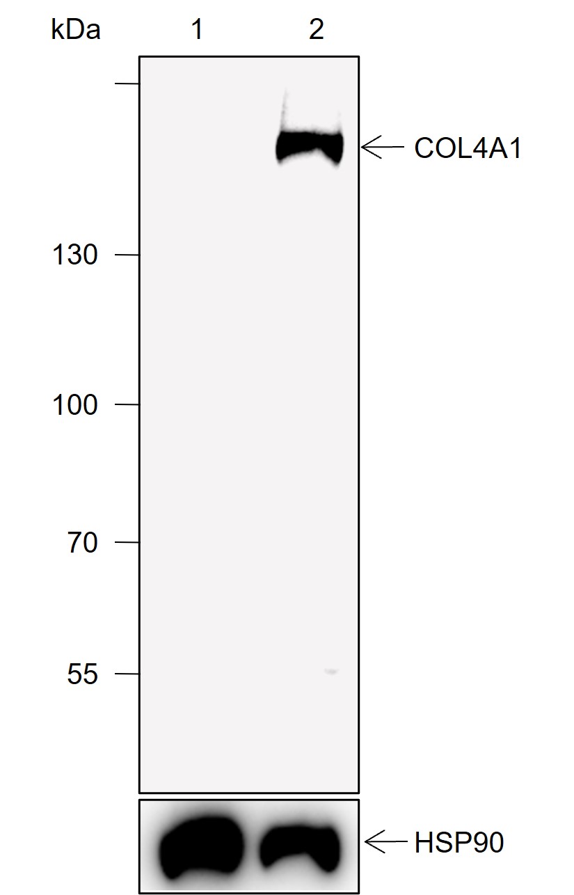 Anti-COL4A1 Rabbit mAb
