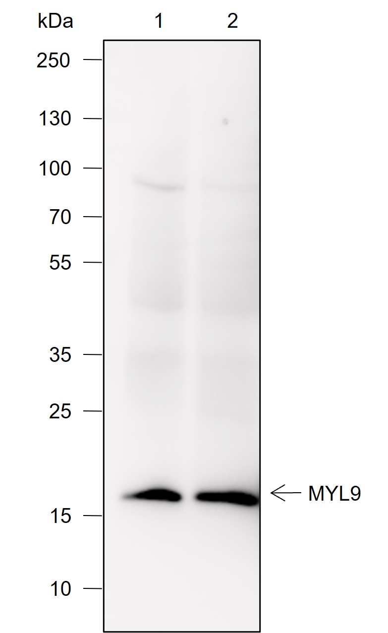 Anti-Myosin Light Chain 2 Rabbit mAb