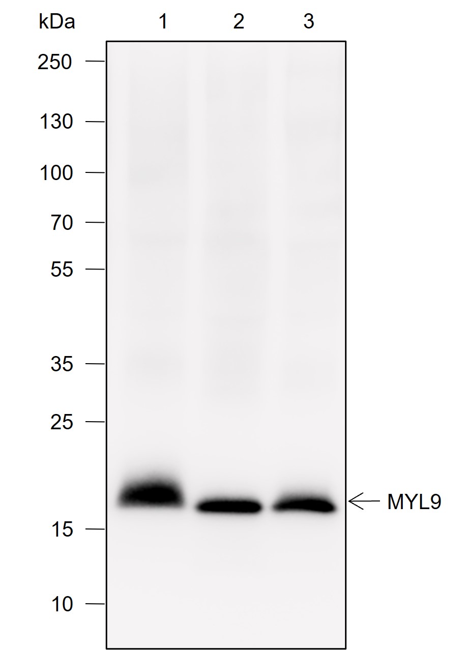 Anti-Myosin Light Chain 2 Rabbit mAb