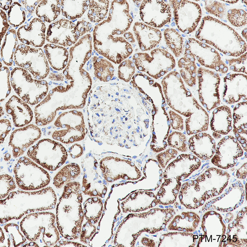 Anti-DLST Rabbit mAb