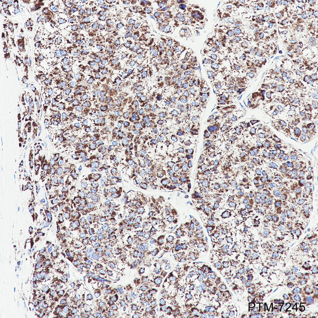 Anti-DLST Rabbit mAb