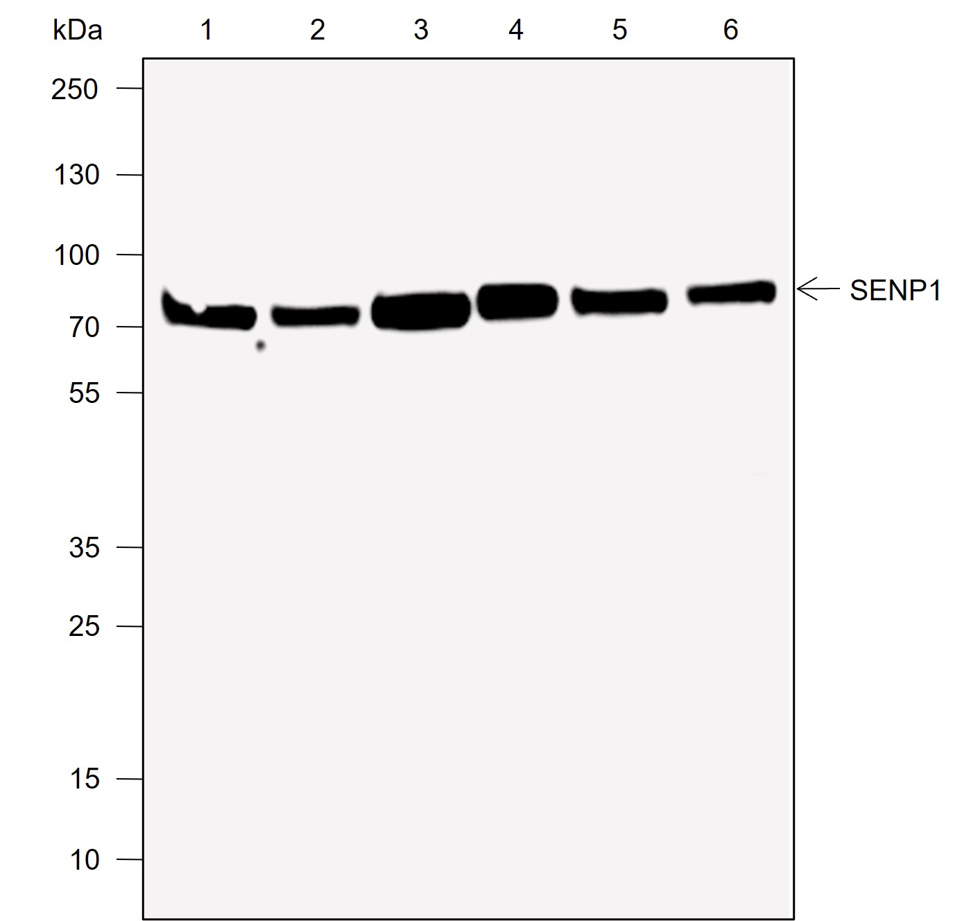 Anti-SENP1 Rabbit mAb