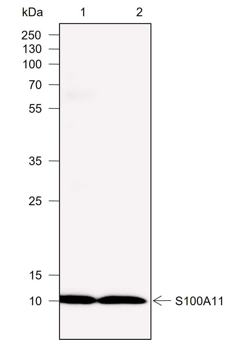 Anti-S100A11 Mouse mAb