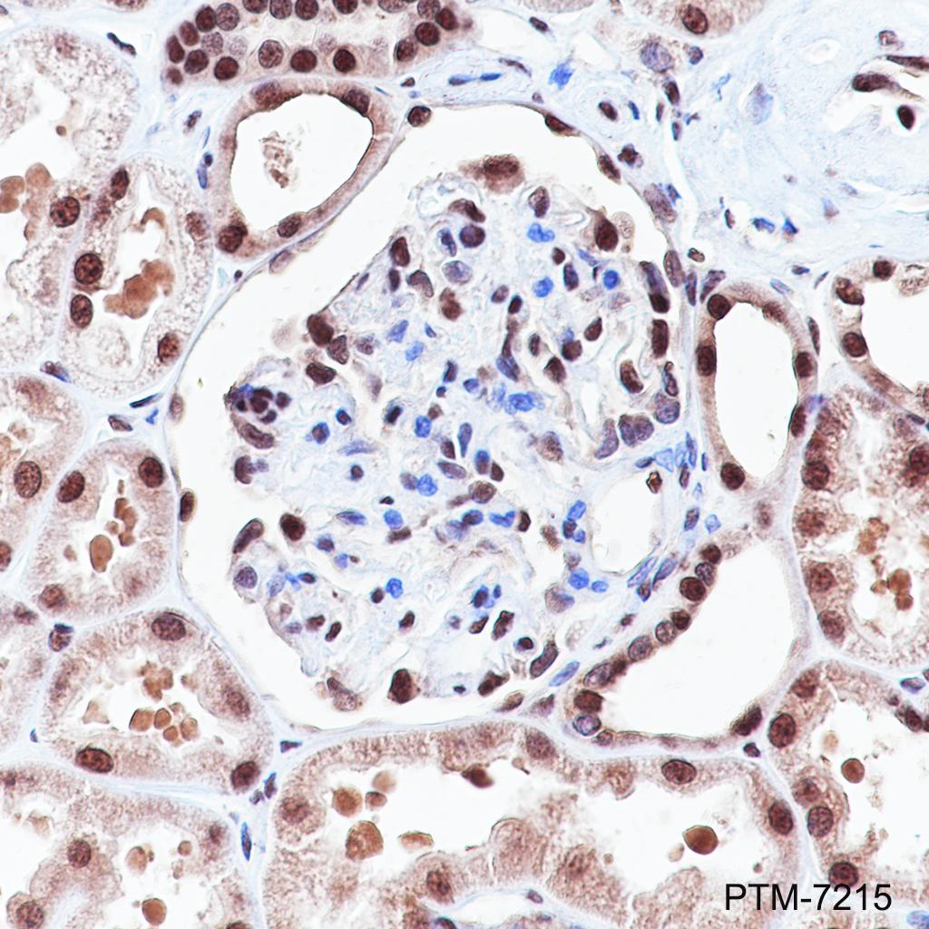 Anti-SRSF3 Rabbit mAb