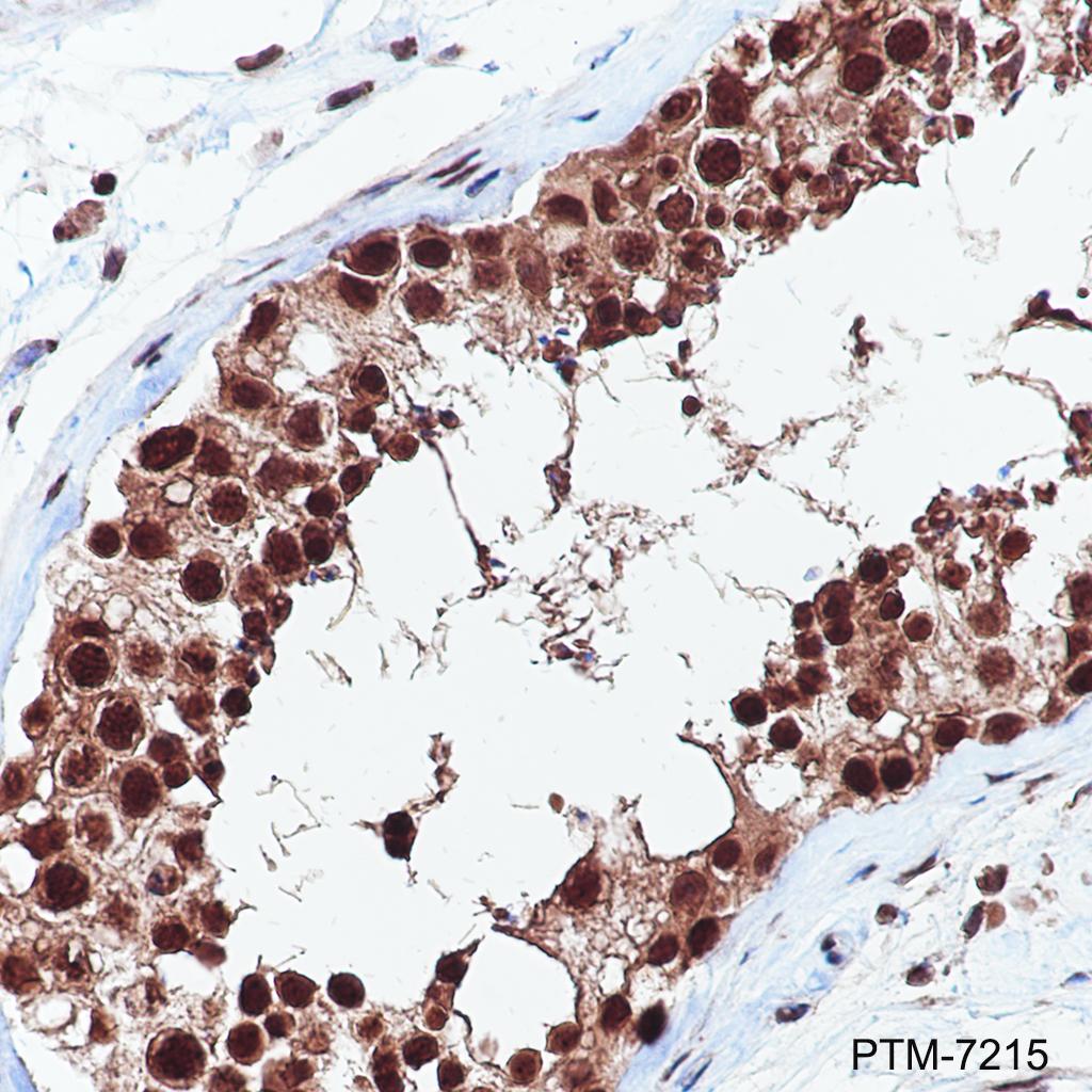 Anti-SRSF3 Rabbit mAb