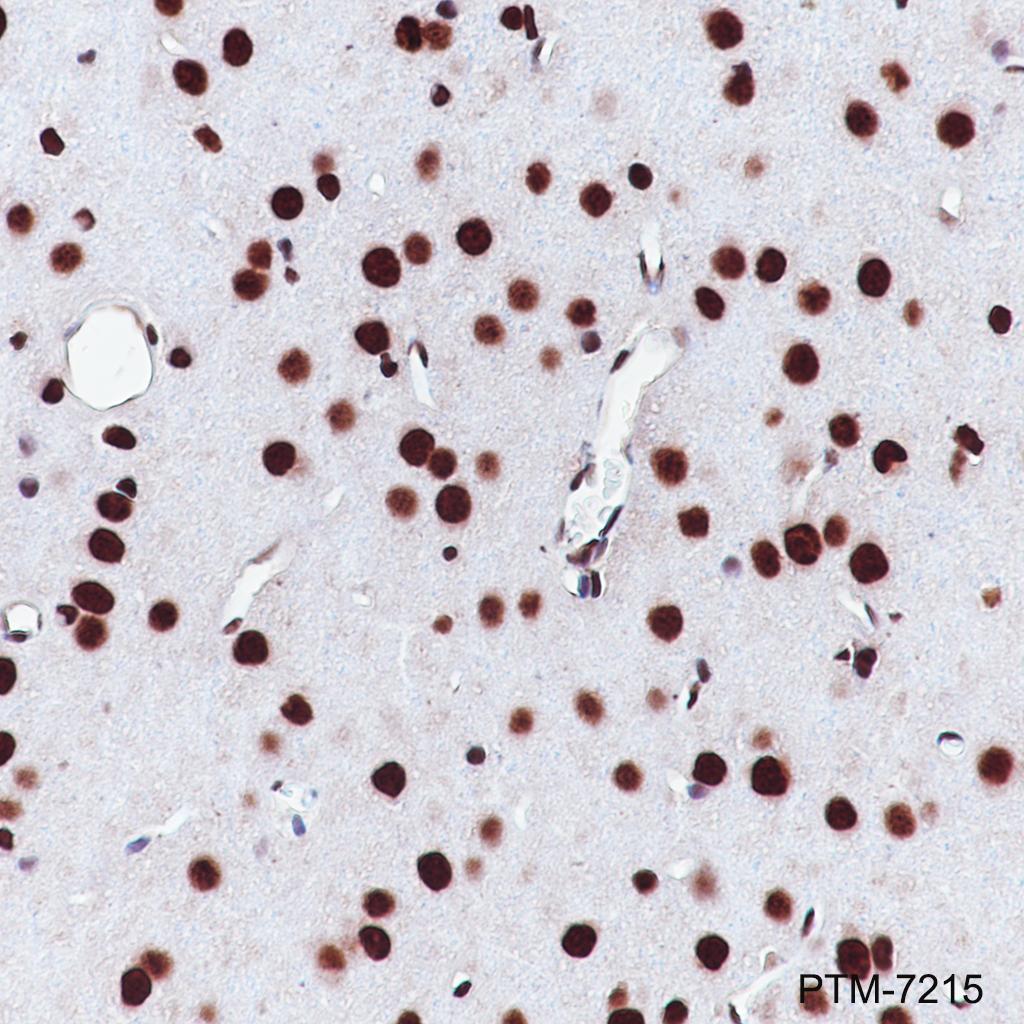 Anti-SRSF3 Rabbit mAb