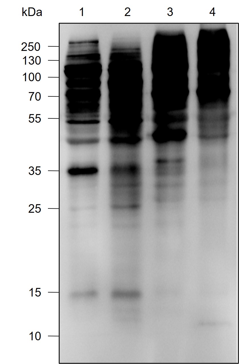 Anti-K63-Linkage Specific Polyubiquitin Rabbit mAb