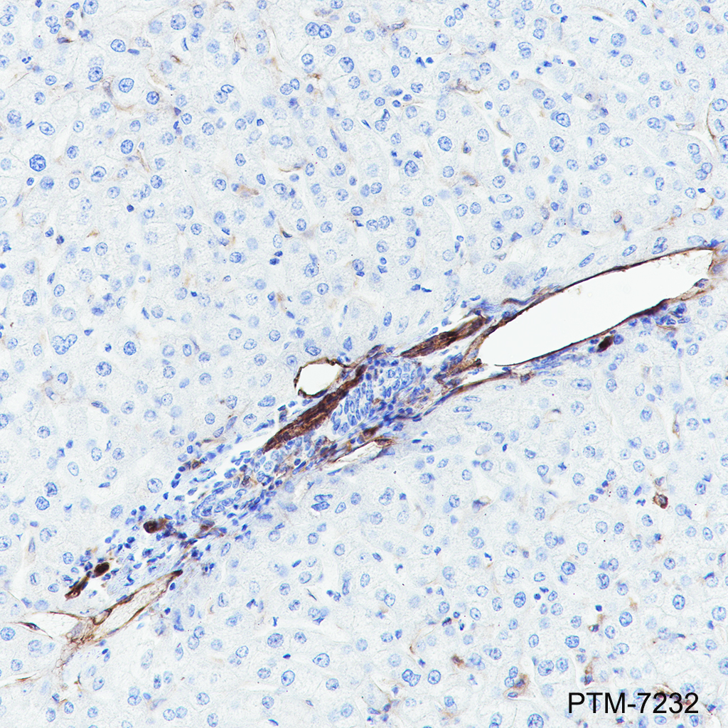 Anti-CD39 Rabbit mAb