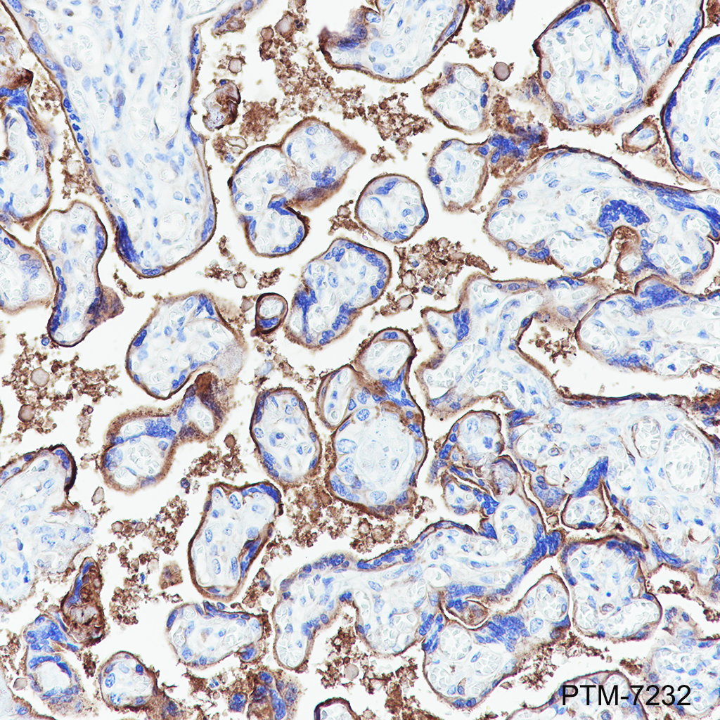 Anti-CD39 Rabbit mAb