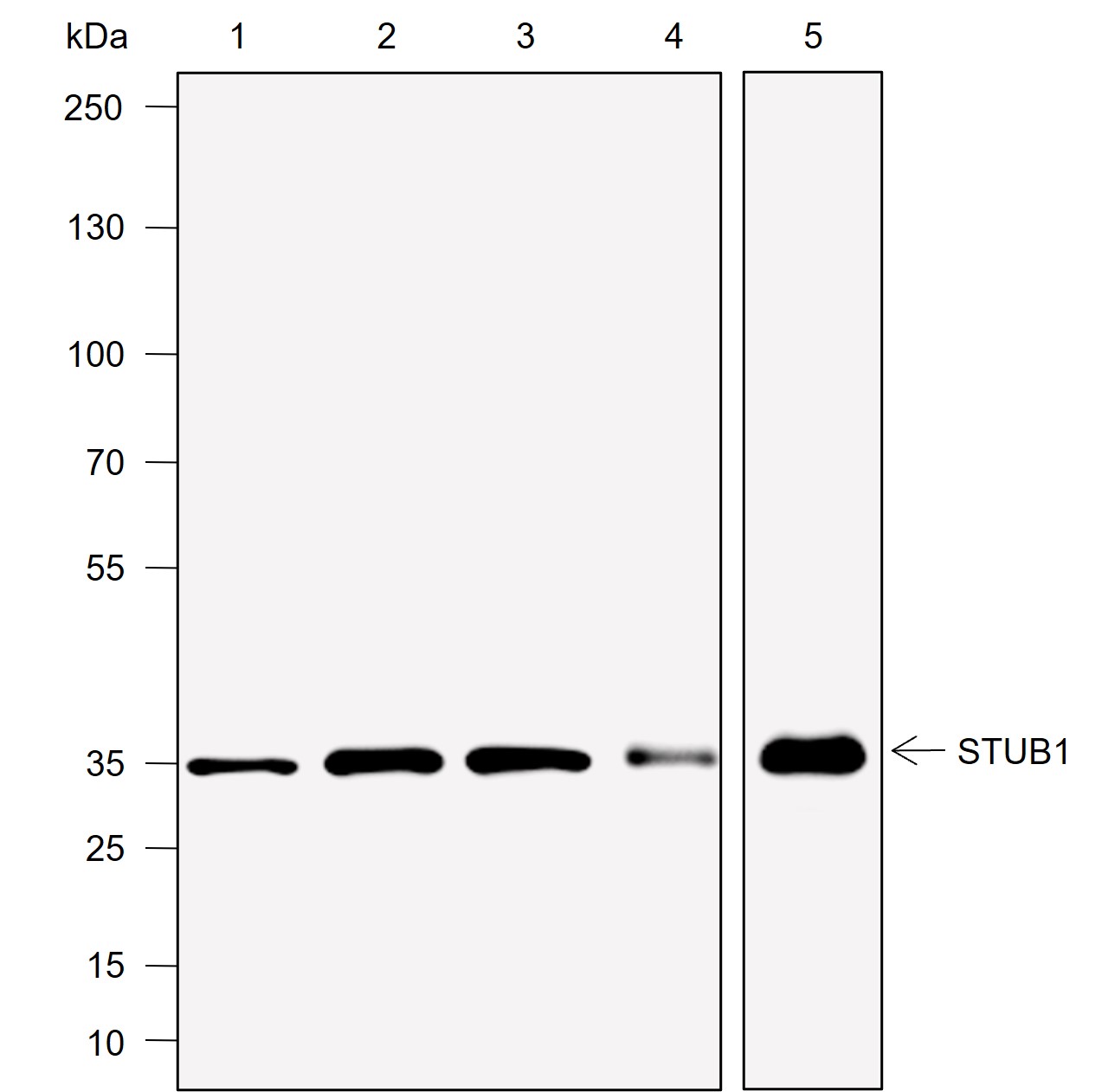 Anti-STUB1 Rabbit mAb