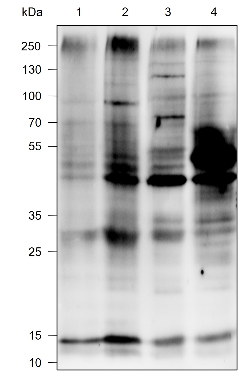 Anti-K48-Linkage Specific Polyubiquitin Rabbit mAb