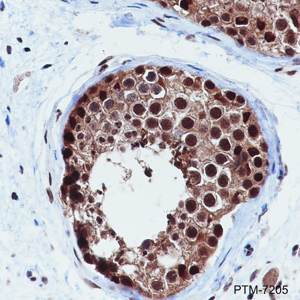 Anti-K48-Linkage Specific Polyubiquitin Rabbit mAb