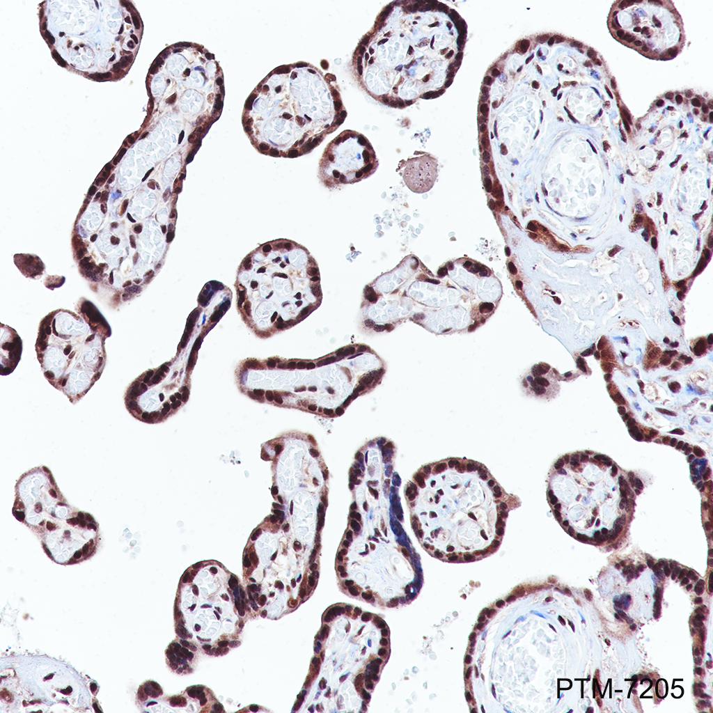 Anti-K48-Linkage Specific Polyubiquitin Rabbit mAb