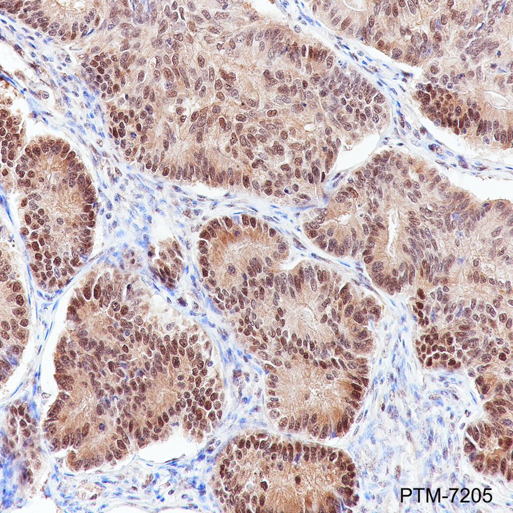 Anti-K48-Linkage Specific Polyubiquitin Rabbit mAb