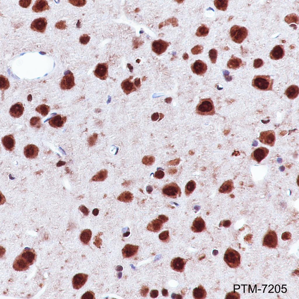Anti-K48-Linkage Specific Polyubiquitin Rabbit mAb
