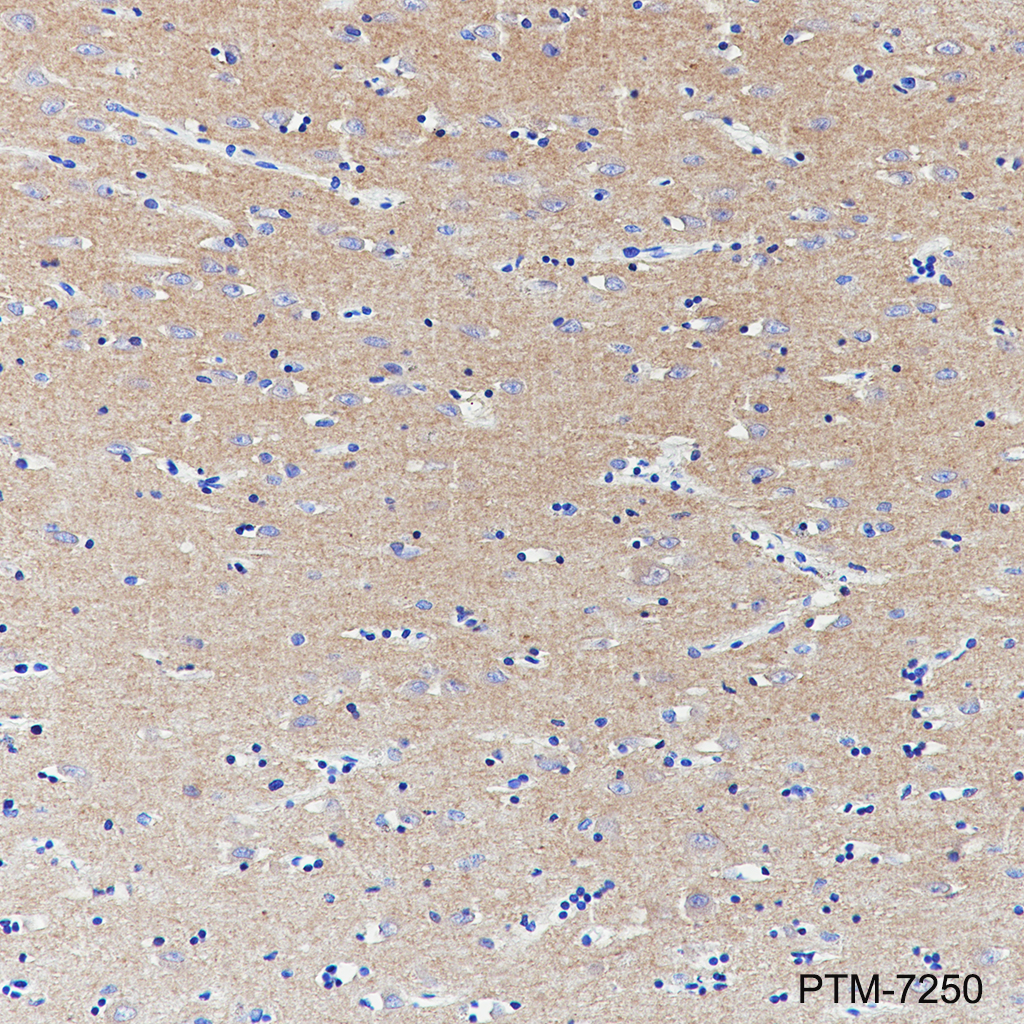 Anti-AMPA Receptor 1 / GluA1 Rabbit mAb