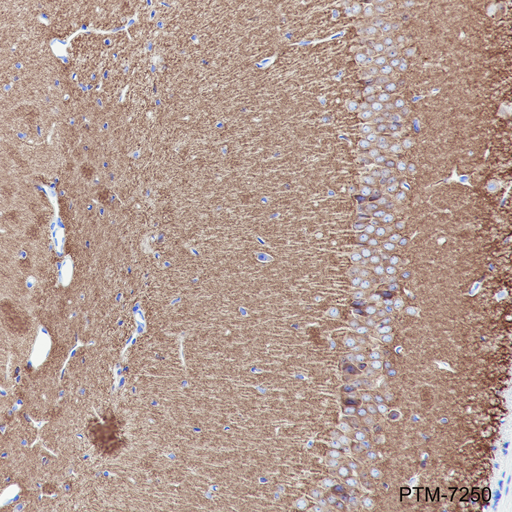 Anti-AMPA Receptor 1 / GluA1 Rabbit mAb